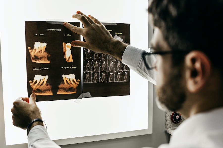 Ai in radiology